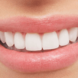 Περιποίηση στόματος